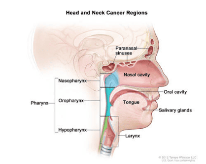 Illustration of head and neck cancer regions: paranasal sinuses, nasal cavity, oral cavity, tongue, salivary glands, pharynx (nasopharynx, oropharynx, hypopharynx) and larynx