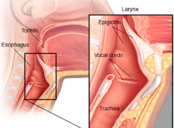 Illustration of the throat showing the tonsils, esophagus and larynx, with an inset of the epiglottis, vocal cords and trachea