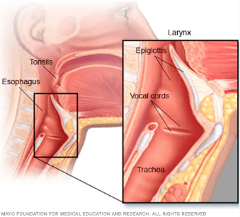 Illustration of the throat showing the tonsils, esophagus and larynx, with an inset of the epiglottis, vocal cords and trachea